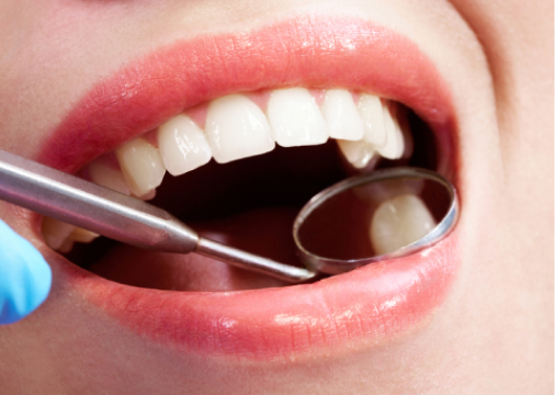Woman experiencing dental exam